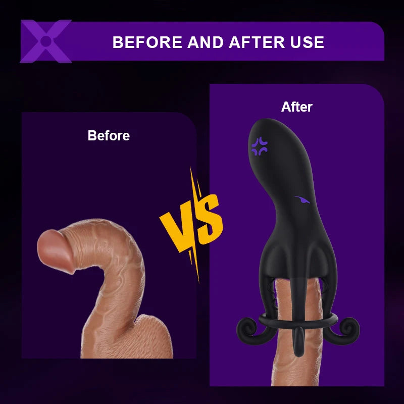 XG11: Hands-Free Octopus Penis Vibrator with C-Ring Support